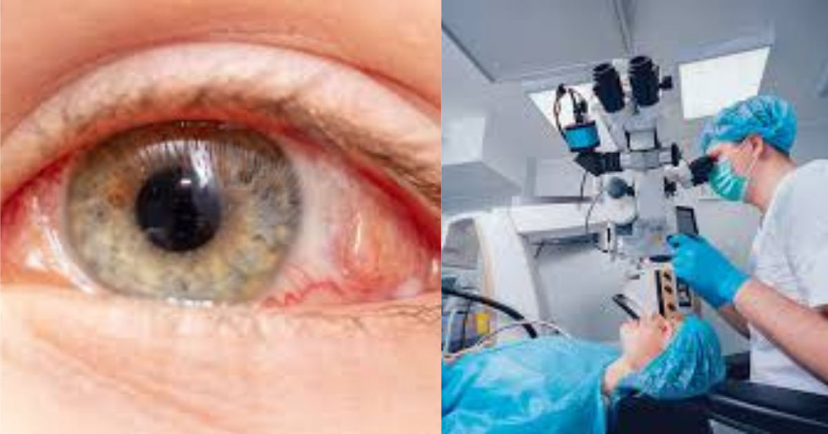 Eye treatment