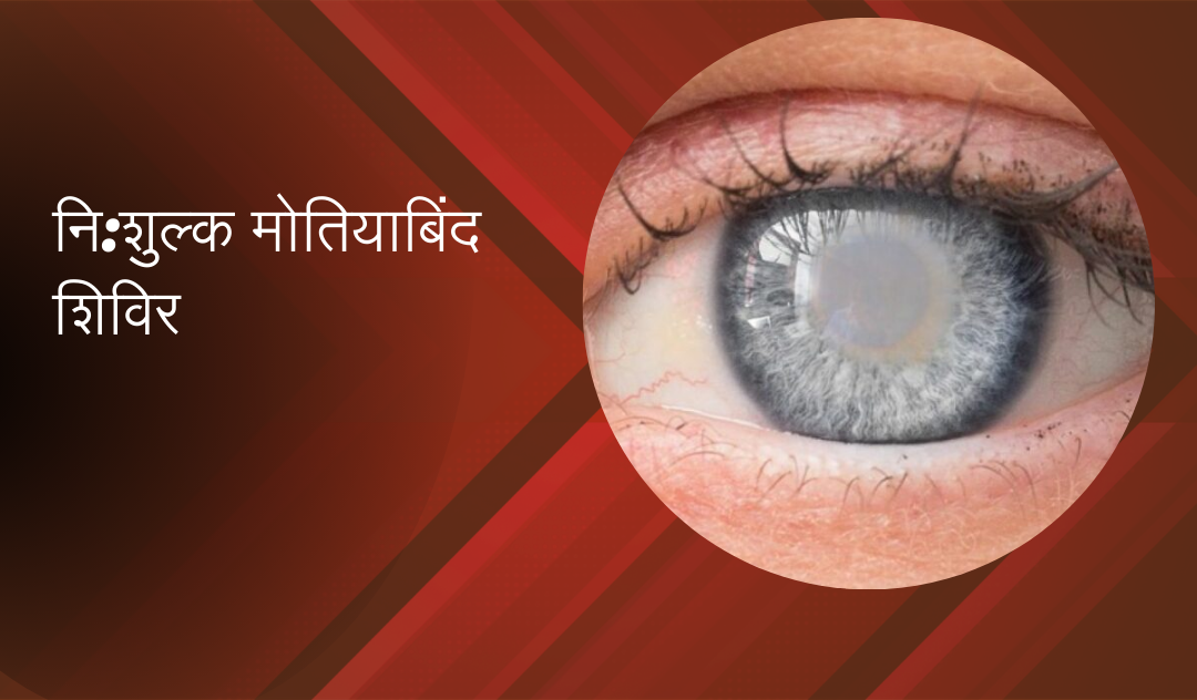 Lions Club द्वारा आयोजित नि:शुल्क: मोतियाबिंद शिविर