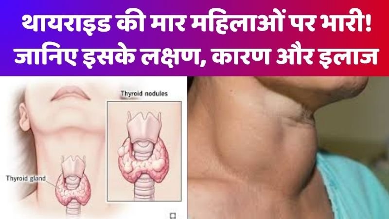 Thyroid