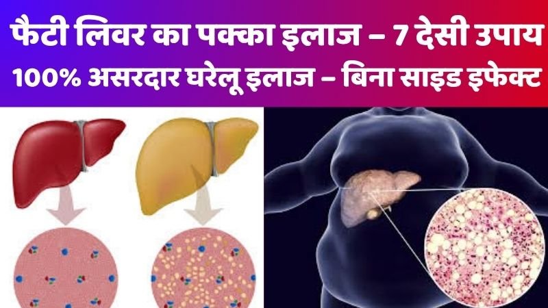 फैटी लिवर