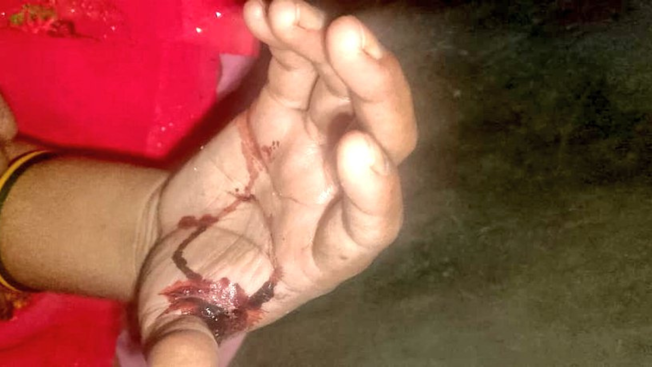 मिर्जापुर के अदलहाट में विधवा महिला को न्याय का इंतज़ार, दिवाली पर दबंगों ने पीटा — पुलिस निष्क्रिय 1 मिर्जापुर के अदलहाट में विधवा महिला को न्याय का इंतज़ार